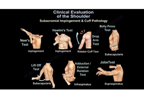 Shoulder Special Tests 